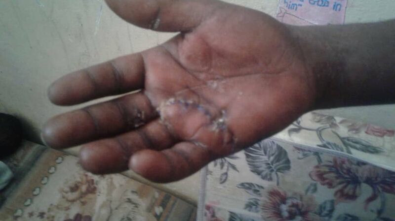 Many refugees and migrants brought to Khoms Souq al Khamis suffered from scabies and other health problems, and weren’t registered before being forced out to smugglers.