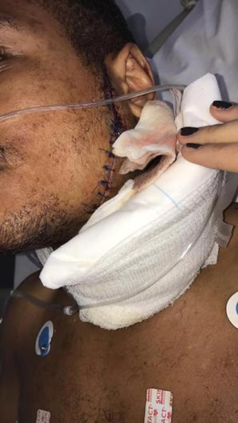 Caoimhin Agyarko Hynes was stabbed outside a fast-food outlet in Belfast’s city centre in 2017, leaving him with a seven-inch scar. Photograph: Eoaghan Junior