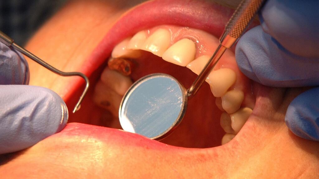 Some readers are pleased that the Government has decided to upscale dental benefits by re-introducing an annual free scale and polish. Dental benefits will also be extended to the self-employed from March 2017. Photograph: John Giles/PA Wire