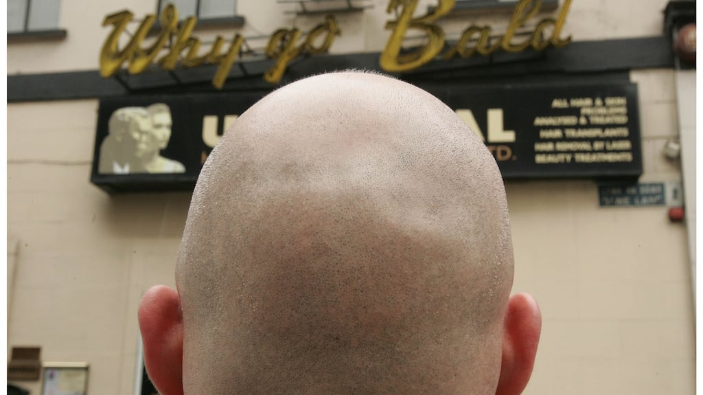 With no hair to grey or to lose my head is now much the same as it was 20 years ago. Photograph: Alan Betson