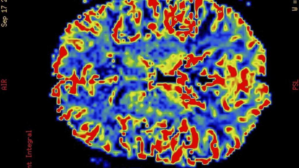 ‘I think cognitive enhancers should be allowed for academics’