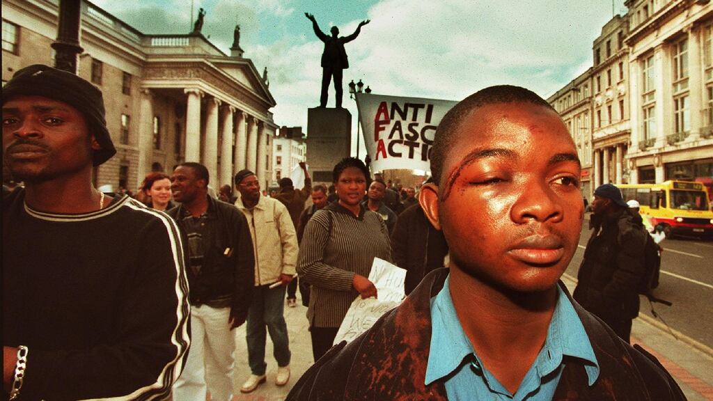 Paul Abayomi, who was attacked in Summerhill, Dublin, taking part in an anti-racist demonstration by refugees on O’Connell Street in Dublin. Photograph: Frank Miller