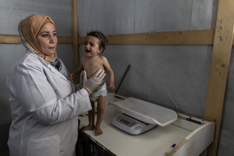 Nujoud Salman, a one-year-old girl who was diagnosed with severe malnutrition at Kamal Adwan Hospital in Jabalia in the Gaza Strip. Photograph: Saher Alghorra/New York Times