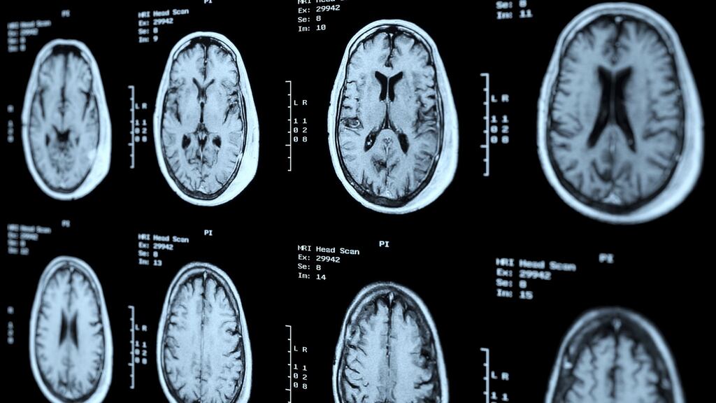 The scientists used MRI scans to see whether various brain regions were similar or different in terms of thickness. Photograph: iStock