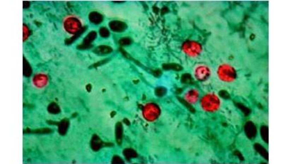 Cryptosporidium is a protozoan found in animal faeces.