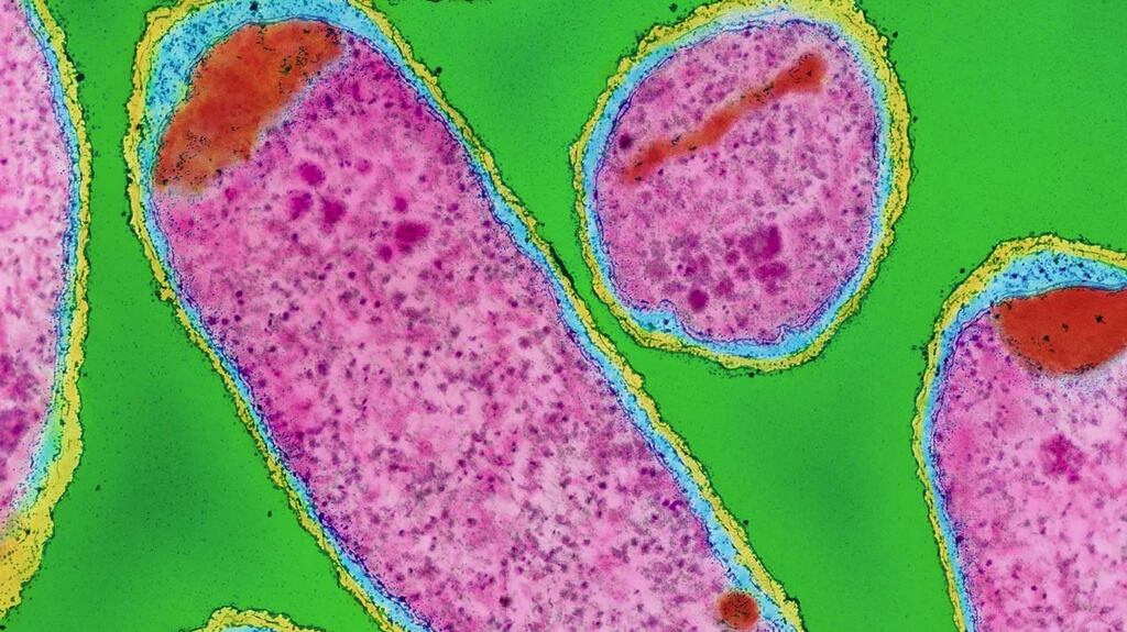 E.coli strain. Photograph:  International Picture Researcher Science Photo Library