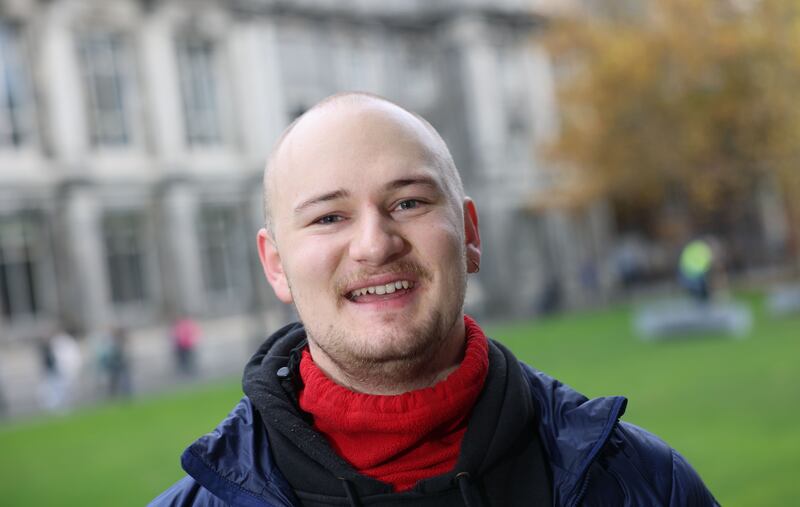 Johann Hedlund: 'You reach a point when you lose enough hair that the only option you really have is to just roll with it, you can’t really hide it any more.' Photograph: Dara Mac Dónaill