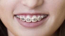 More than 18,200 children   waiting for orthodontic treatment