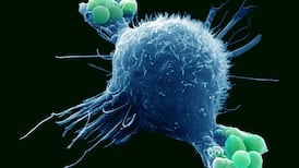 No evidence HSE has superbug under control, scientist warns