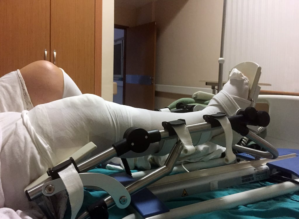 A new bone glue developed by Shannon-based company Biomimetic Innovations has secured FDA breakthrough device designation. Photograph: iStock