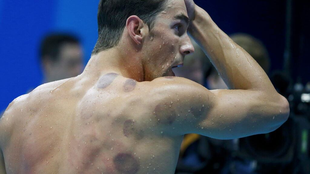 Michael Phelps is seen with red cupping marks on his shoulder ahead of the heats of the men’s 200m butterfly in Rio on Monday. Photograph: Michael Dalder/Reuters