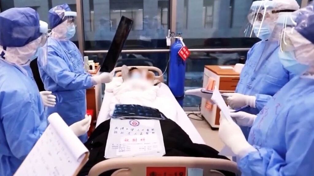 Wuhan outbreak: an early Covid-19 patient in hospital in China