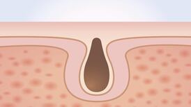 Marian Keyes: Exfoliating dead skin from my face is one of my favourite things