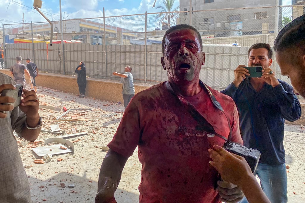 Palestinian photojournalist Hatem Omar was injured in an Israeli strike on Nasser Hospital in Khan Younis, in the southern Gaza Strip, on August 25th. Photograph: AFP via Getty Images