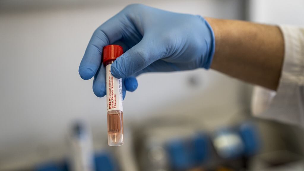 A lab worker shows a vial containing an infected swab during a coronavirus test. Photograph: Federico Bernini/Bloomberg