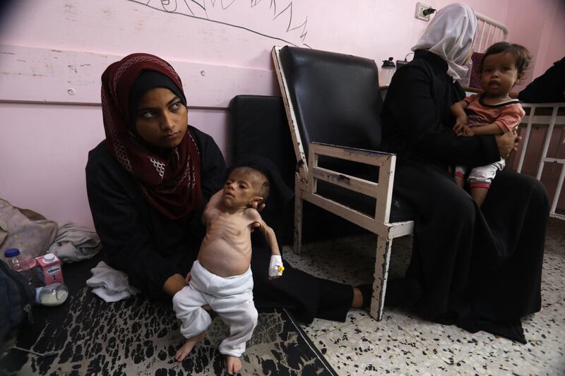 Yasmine (22) and her malnourished two-months-old daughter Teen await treatment at the Nasser hospital in Khan Yunis on July 24th. Photograph: AFP/Getty