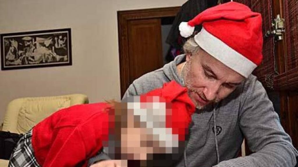 Fernando Blanco with his 11-year-old daughter Nadia who suffers from the rare genetic disease, trichothiodystrophy