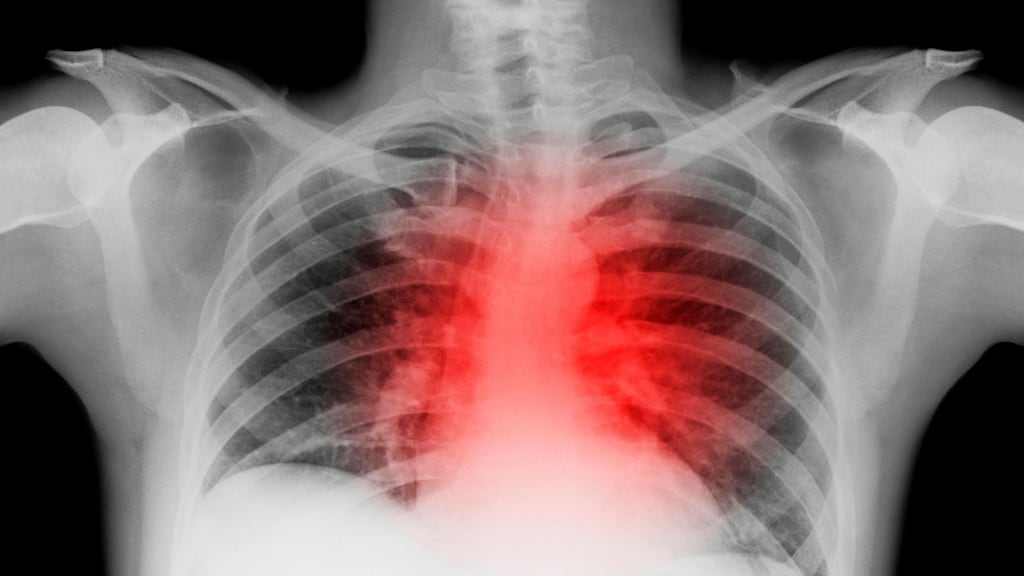 A complaint has been made by the Health Service about the radiologist to the Medical Council, who worked in Canada and the United Kingdom before taking up the post in Kerry.