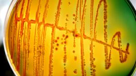 Superbugs poised to become humanity’s greatest killer