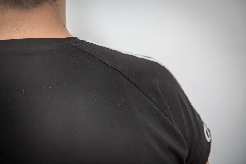 Ibrahim says he was beaten in prison. Photograph: Sally Hayden