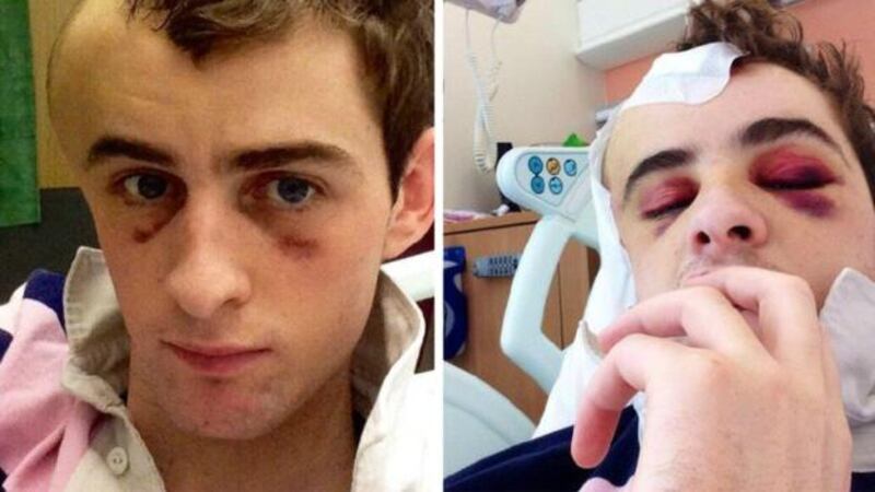 Brian Toomey recovering from his life-threatening fall at Perth.