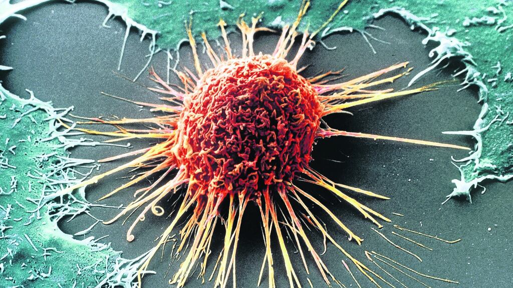 File image of a cancer cell. Scientists have discovered a process to trigger the death of cancer cells that they believe could be more effective than current methods.