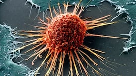 Technology glitch - ‘All I wanted to get was my CervicalCheck results’