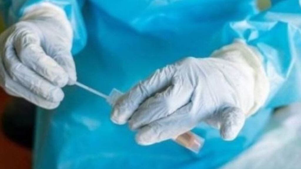 Twenty-two people have tested positive in a single outbreak of Covid-19 among the Roma community