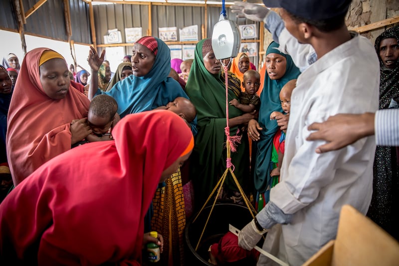 A child is screened for malnutrition at a health clinic in Baidoa, Somalia. Photograph: Sally Hayden