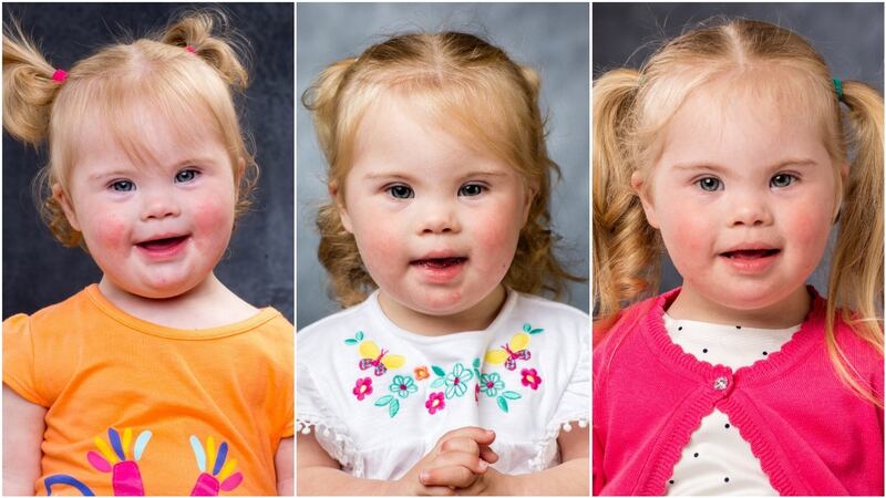 Caoimhe photographed in 2016, ’17 and ’18. Caoimhe is the youngest of three, with a brother, Daniel (8), and a sister, Aisling (6).