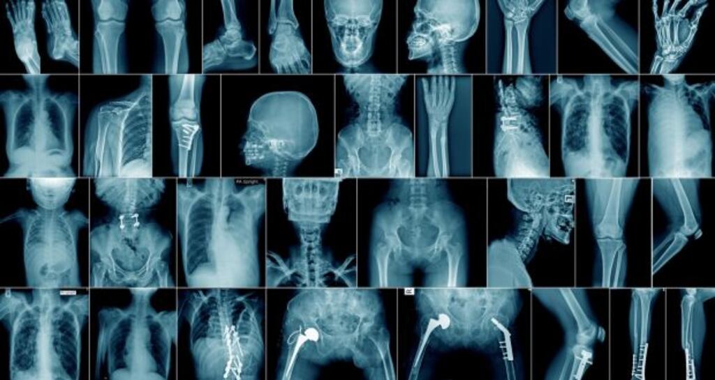 A radiographer has claimed a fitness to practice inquiry had proceeded unfairly in her absence. Photograph: iStock