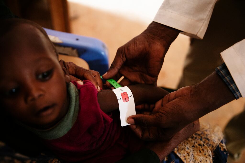 Workers assess a child for malnutrition in Doolow, Somalia last month. The worst drought in four decades, and a sharp rise in food prices caused by the war in Ukraine, have left almost half of Somalia’s people facing acute food shortages. Photograph: Malin Fezehai/The New York Times