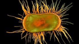 E.coli found in 5% of private water supplies, EPA warns