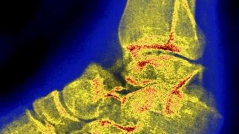 Boy (3) who fractured foot at Dublin creche awarded €12,000