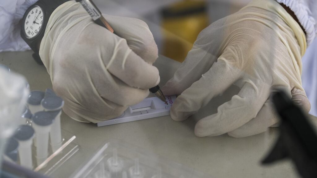 The regulator said retailers were removing the Genrui test from sale on a voluntary basis ‘pending further investigation’. Photograph: Veejay Villafranca/Bloomberg