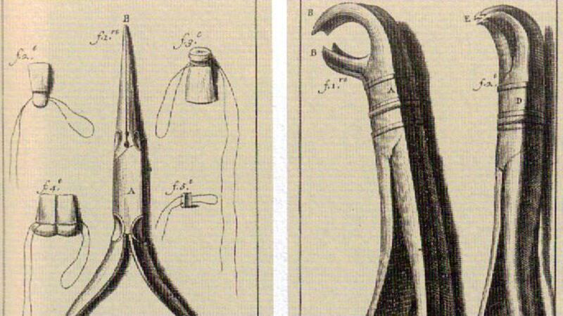 Tools of the trade: crude dental instruments.