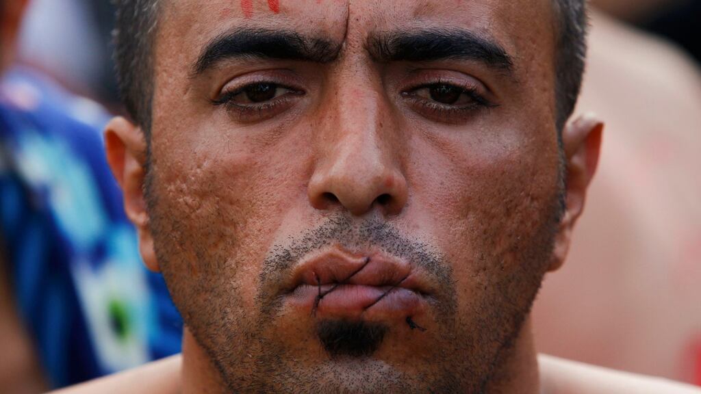 A migrant with his mouth sewn shut in protest sits near the Greece-Macedonia border: When asked where he wanted to go, the man, a 34-year-old electrical engineer named Hamid, said: “To any free country in the world. I cannot go back. I will be hanged.” Photograph: Ognen Teofilovski/Reuters
