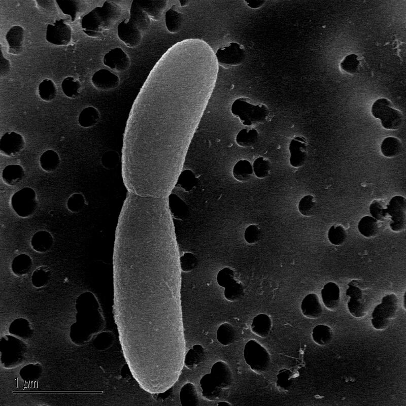 Bacteroides thetaiotaomicron, a beneficial gut microbe. Photograph: Mao Taketani/The New York Times