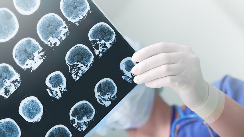 In an ideal scenario, stroke is identified quickly and the patient whisked to a specialised hospital where the waiting medical team administer clot-busting drugs, and then scan the brain so the location of the clot can be established. Photograph: iStock