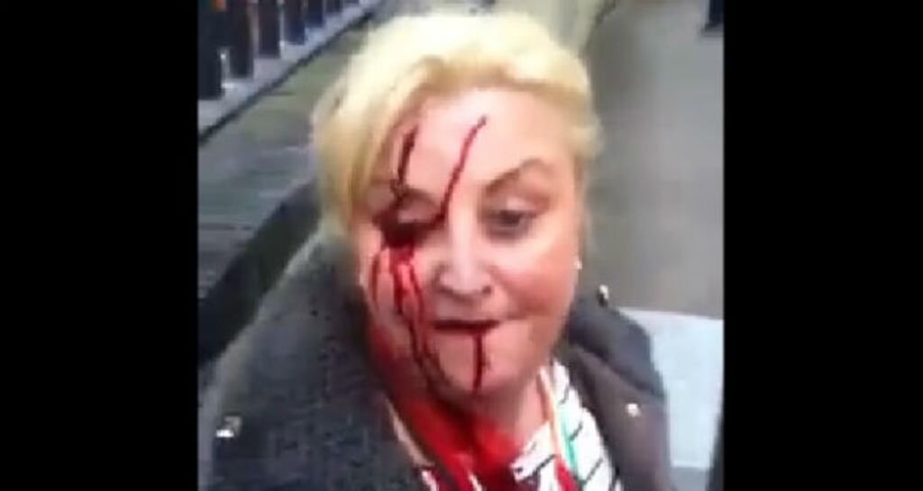 A screengrab from a video posted on the Balbriggan and surrounding areas against water charges Facebook page showing an anti-water charge protester injured during a demonstration outside Fingal county hall in Swords, Co Dublin.