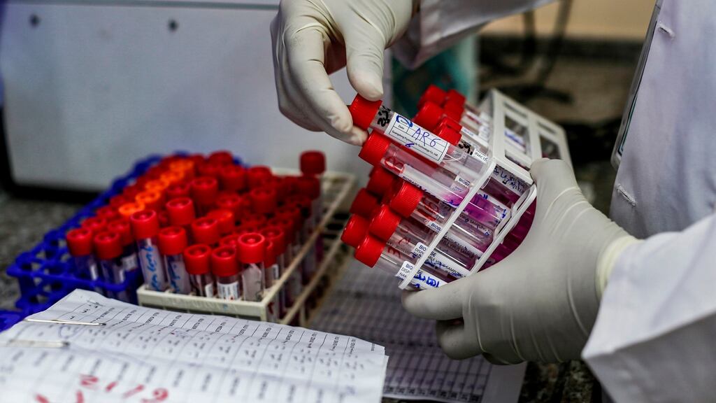 Covid-19 was circulating in Ireland at least two weeks before the first positive case was identified, a new study suggests. Photograph: Mahud Hams/AFP via Getty Images