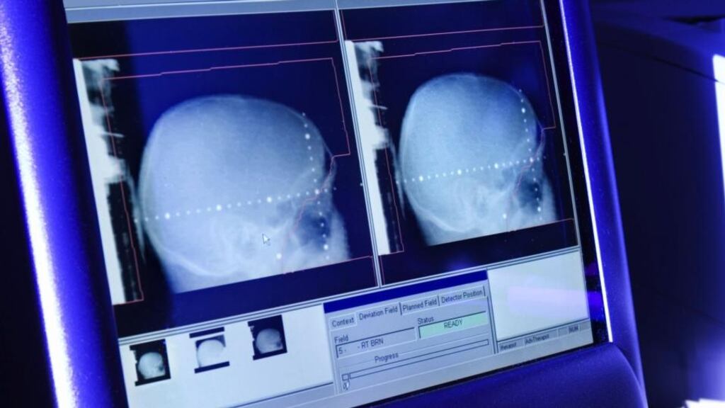 File image of a CT scan on a screen.