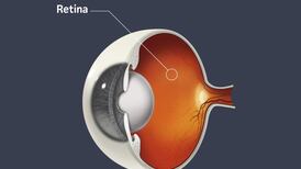 Potential remedy for most common cause of blindness