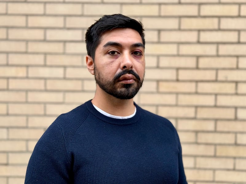 Jairo Guzmán needed stitches and hospital care for severe facial injuries. Photograph: Alekson Lacerda