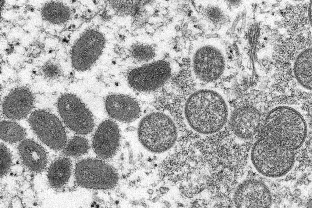 The European Medicines Agency has said the smallpox vaccine made by Bavarian Nordic should also be authorised against monkeypox. Photograph: Cynthia S Goldsmith, Russell Regner/CDC/AP/PA