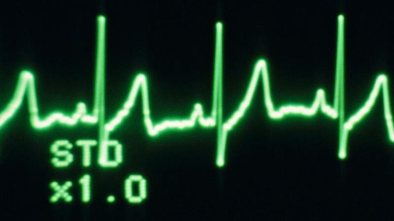 The Sláintecare action plan is centred on a citizen-care master plan.