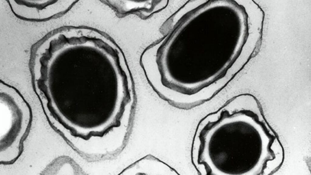 A microscopic view of anthrax spores. Photograph: AFP