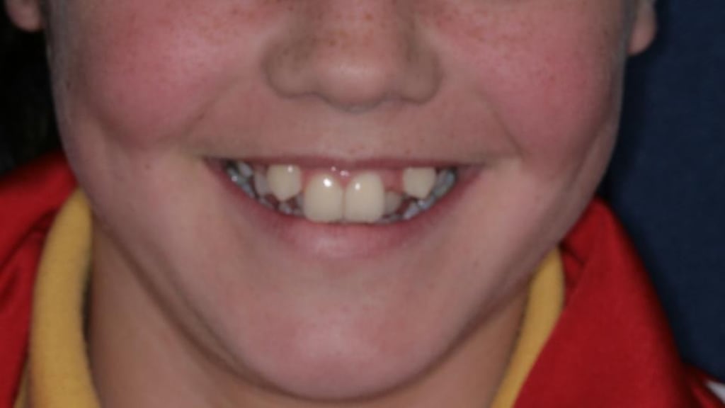 Stacey McNulty before her treatment.