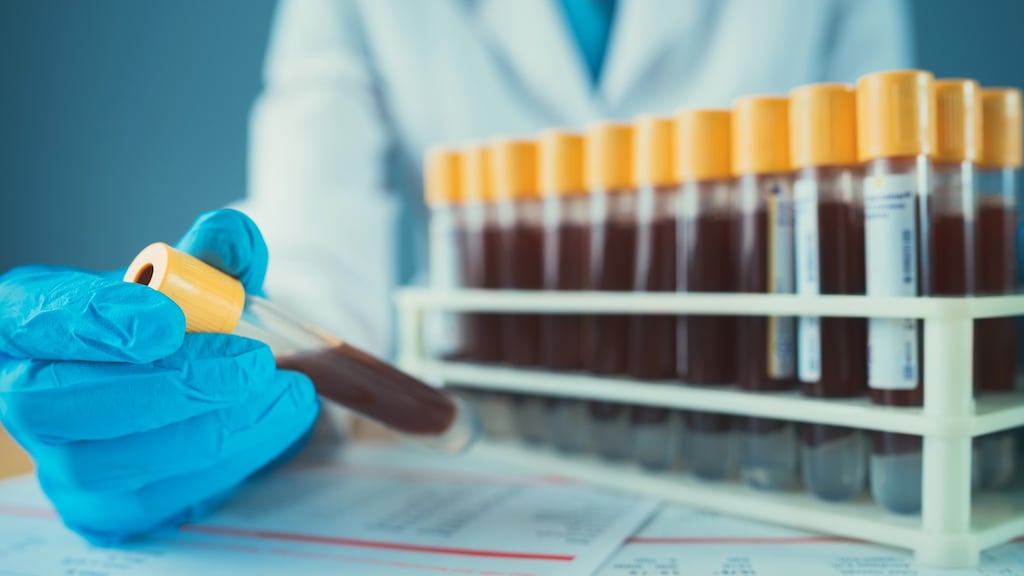 Eighty per cent of the 11 million people globally who die from sepsis each year could survive with rapid diagnosis and treatment.