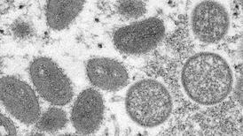 The Irish Times view on the monkeypox outbreak: serious but containable